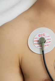 허혈성 심장질환