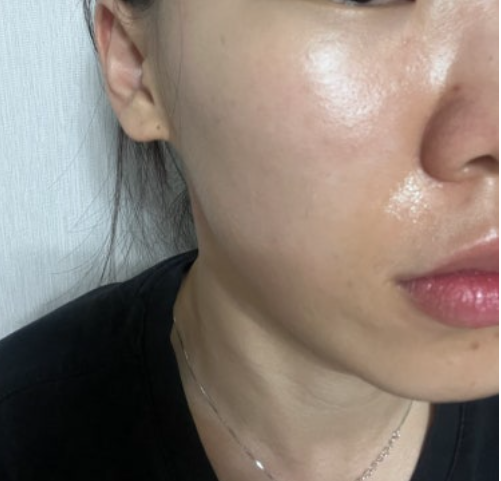 시리즈 a+f 사용 