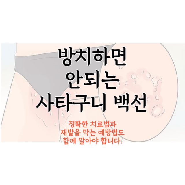 사타구니-백선