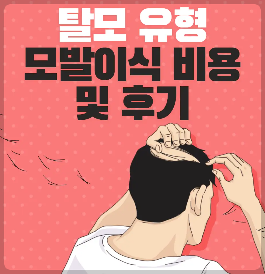 탈모 유형과 모발이식 비용