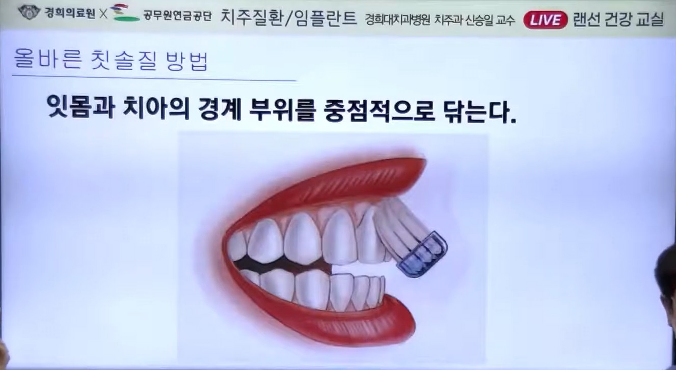 잇몸병-신승윤-교수