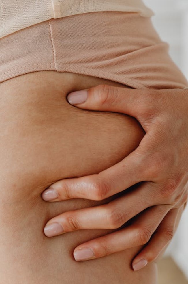 셀룰라이트 생기는 이유