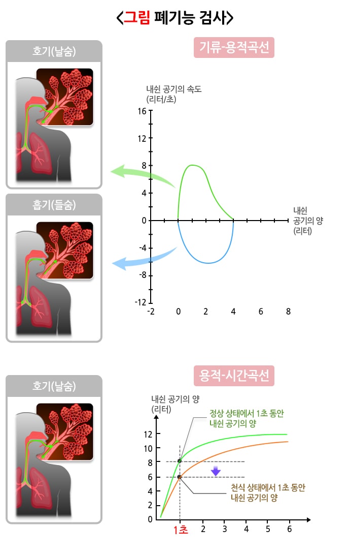 폐기능검사