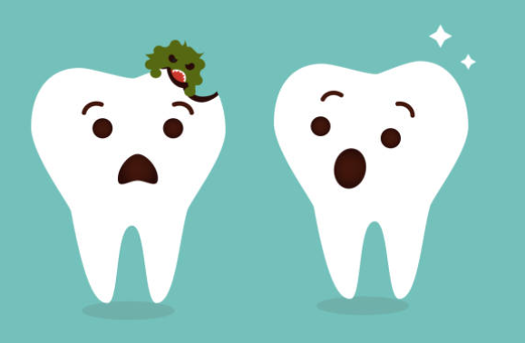충치 자연치유 단계별 사진 및 초기 증상