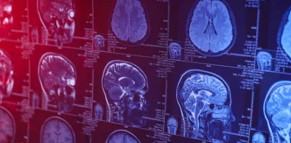 중독의 원인, 중독이 뇌에 미치는 영향