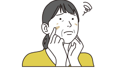 검버섯