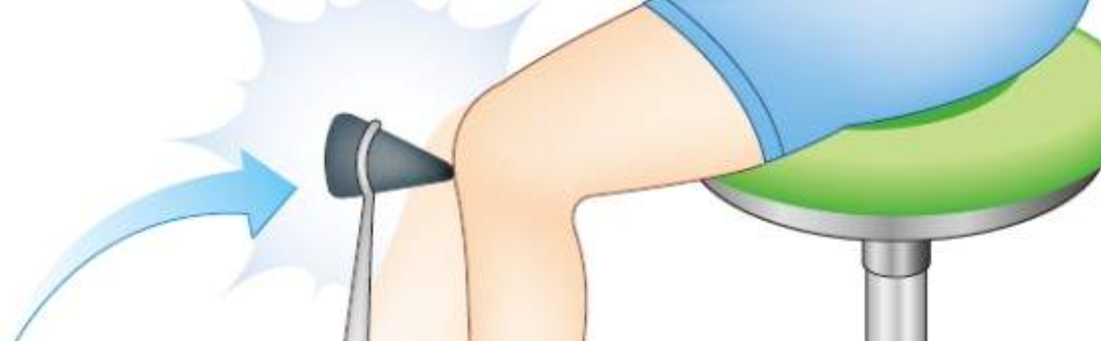 무릎 부분의 무조간 반사 모습