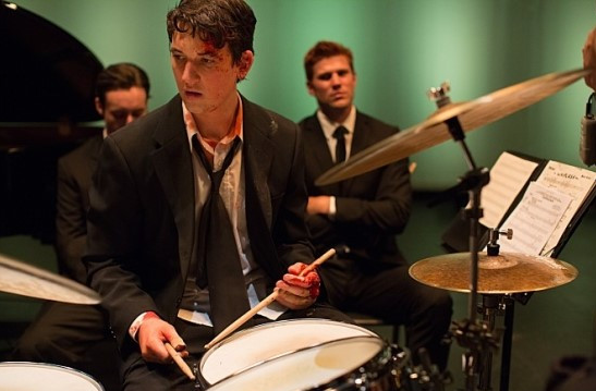 교통사고에도 불구하고 연주를 하는 앤드류