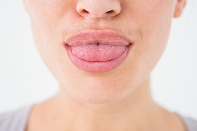 혀가 갈라지는 이유