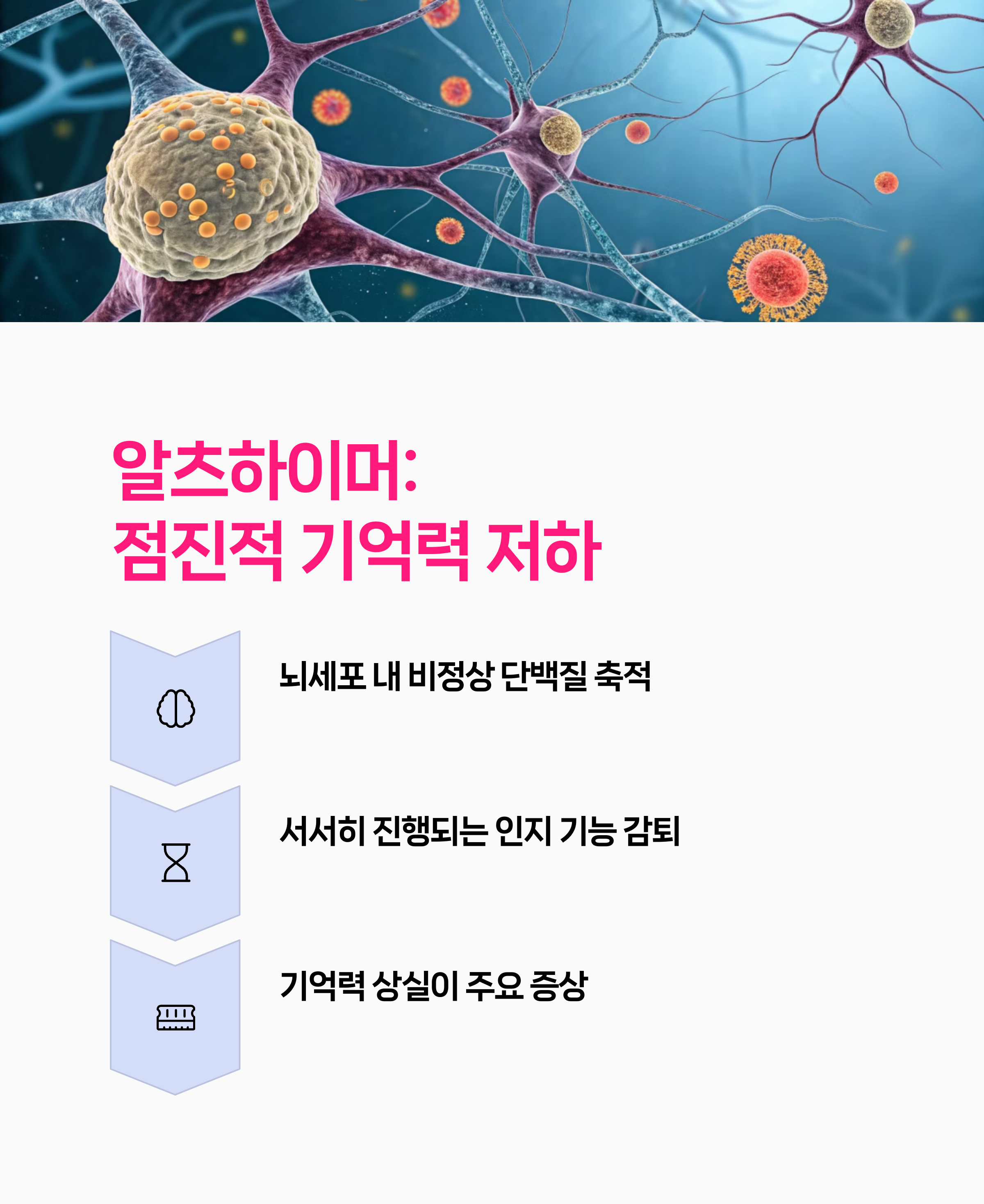 혈관성치매