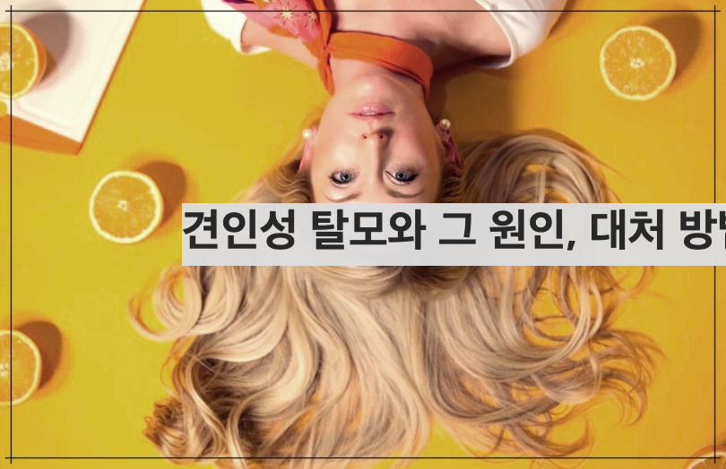 견인성 탈모와 그 원인&#44; 대처 방법.