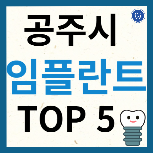 충청남도 공주시 임플란트 치과 추천