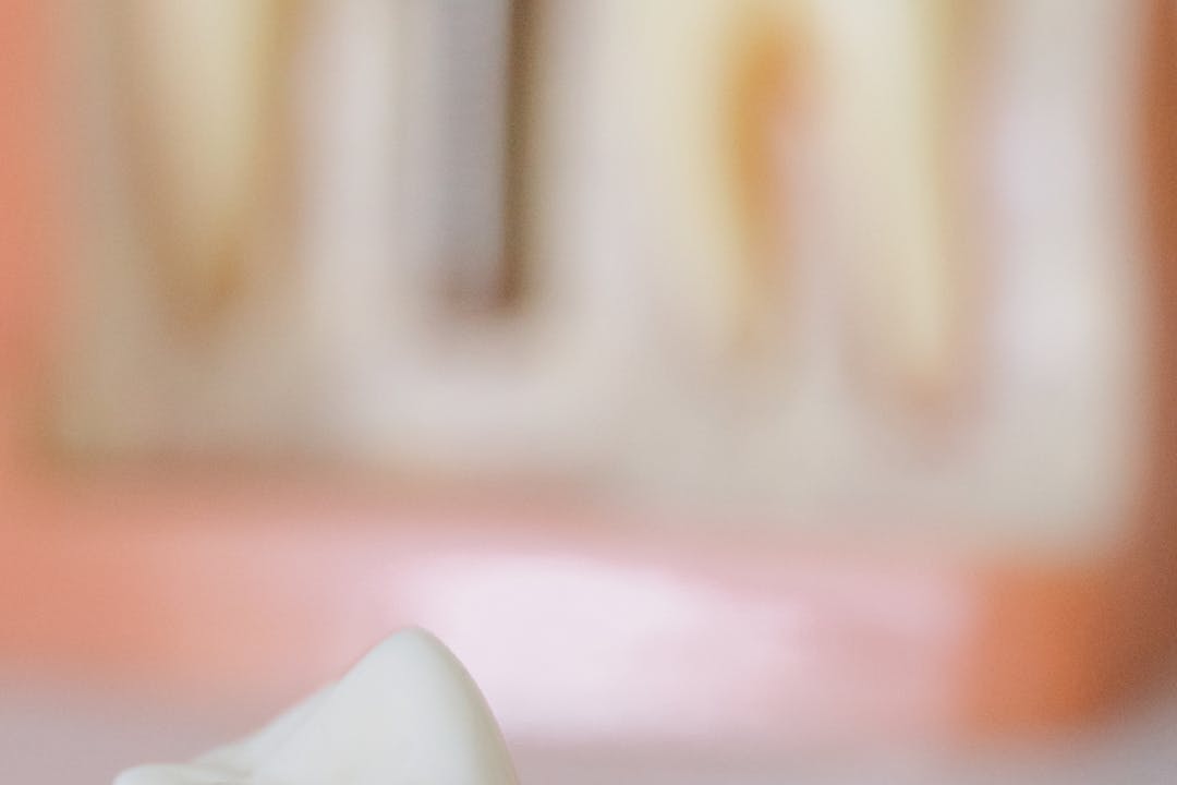 임플란트 관련사진5