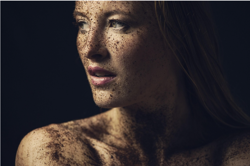 스티븐스-존슨 증후군(Stevens-Johnson Syndrome, SJS) 완전 가이드