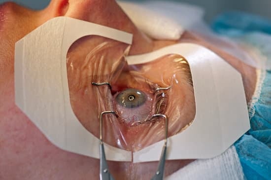 스마일라식(SMILE LASIK) &ndash; 각막 손상 최소화 시력 교정술