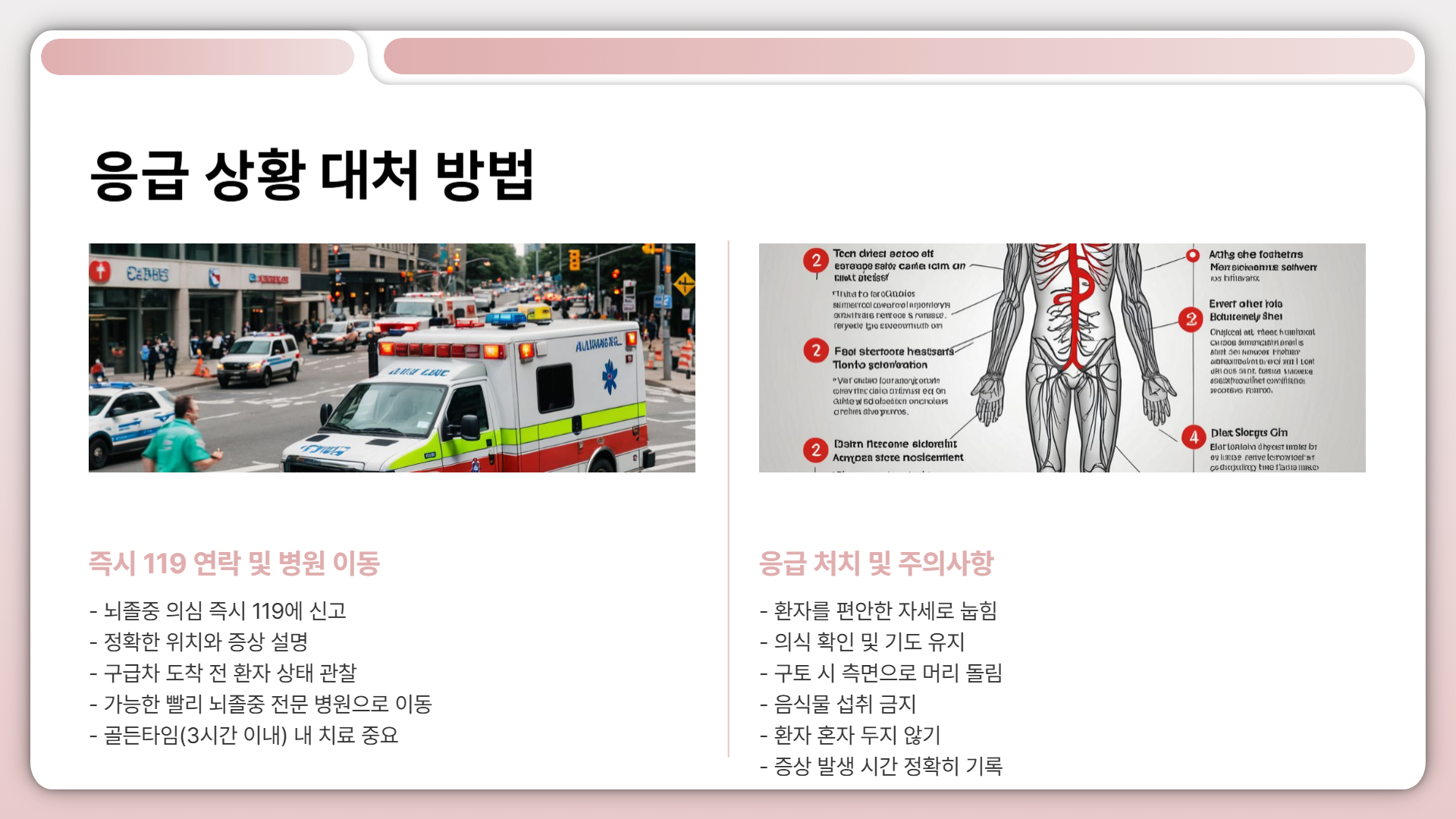 뇌졸중 증상 조기 발견을 위한 필수 정보