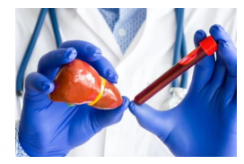 감마지티피-사진6