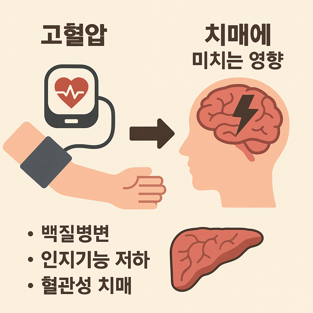 고혈압과 치매관계