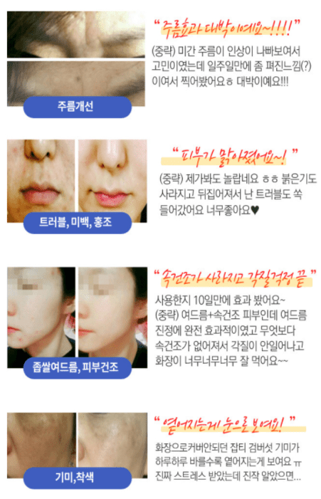 기미 모공 제거