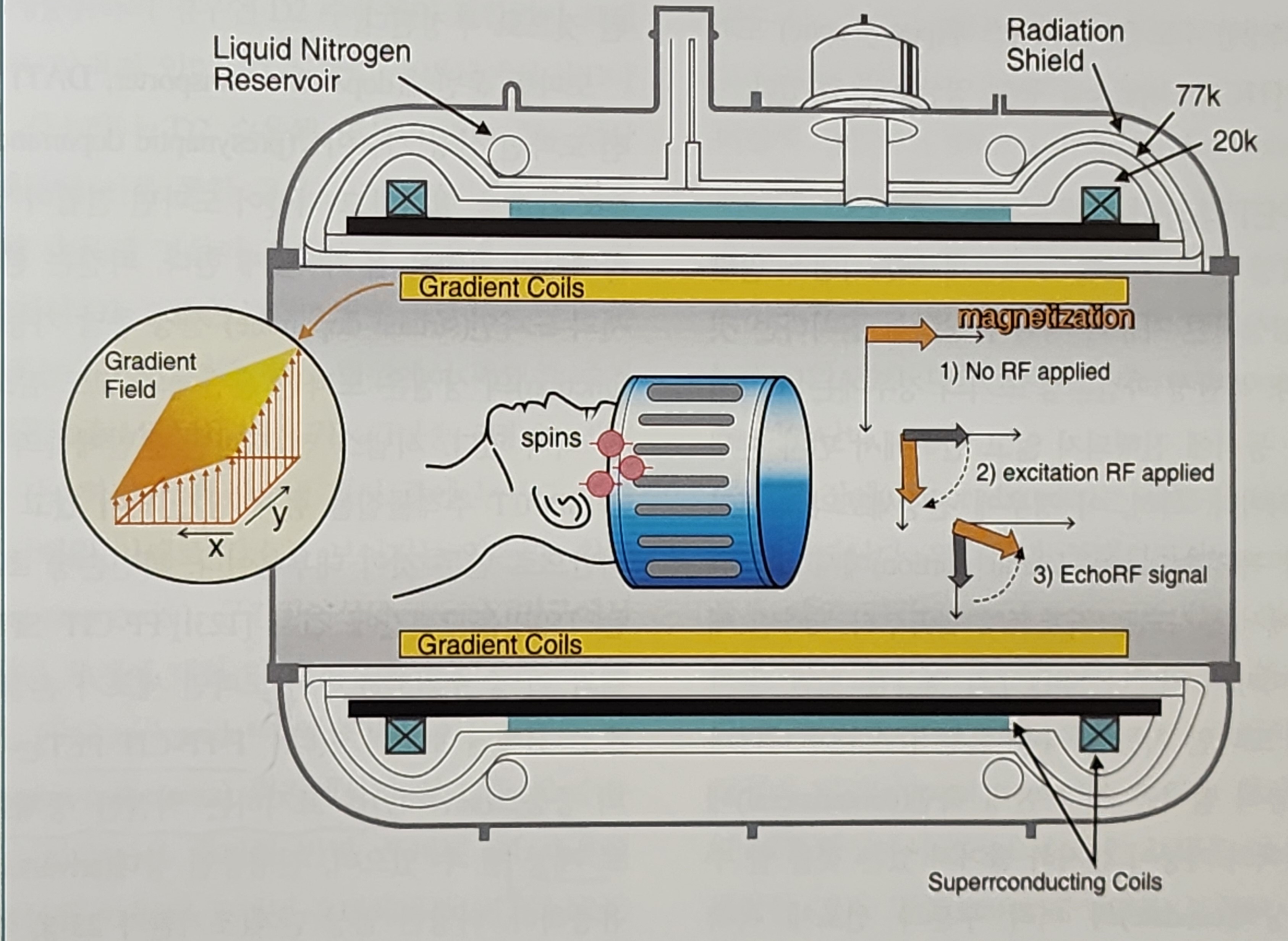 이상운동 질환의 영상기법