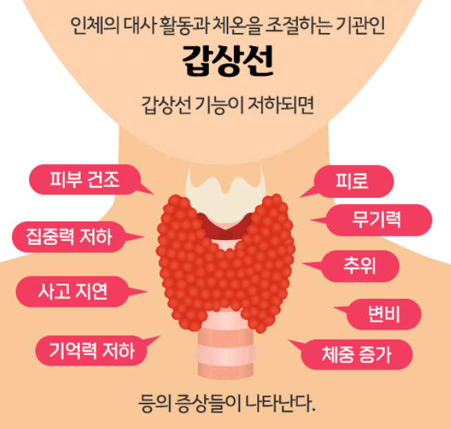 갑상선 기능 저하증 증상
