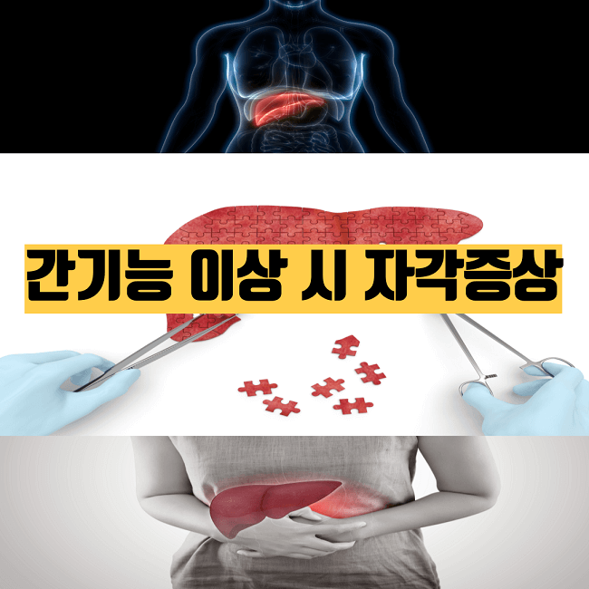 간기능 이상 나타나는 자작 증상 썸네일