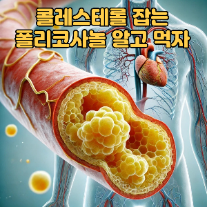 콜레스테롤 줄이는 방법