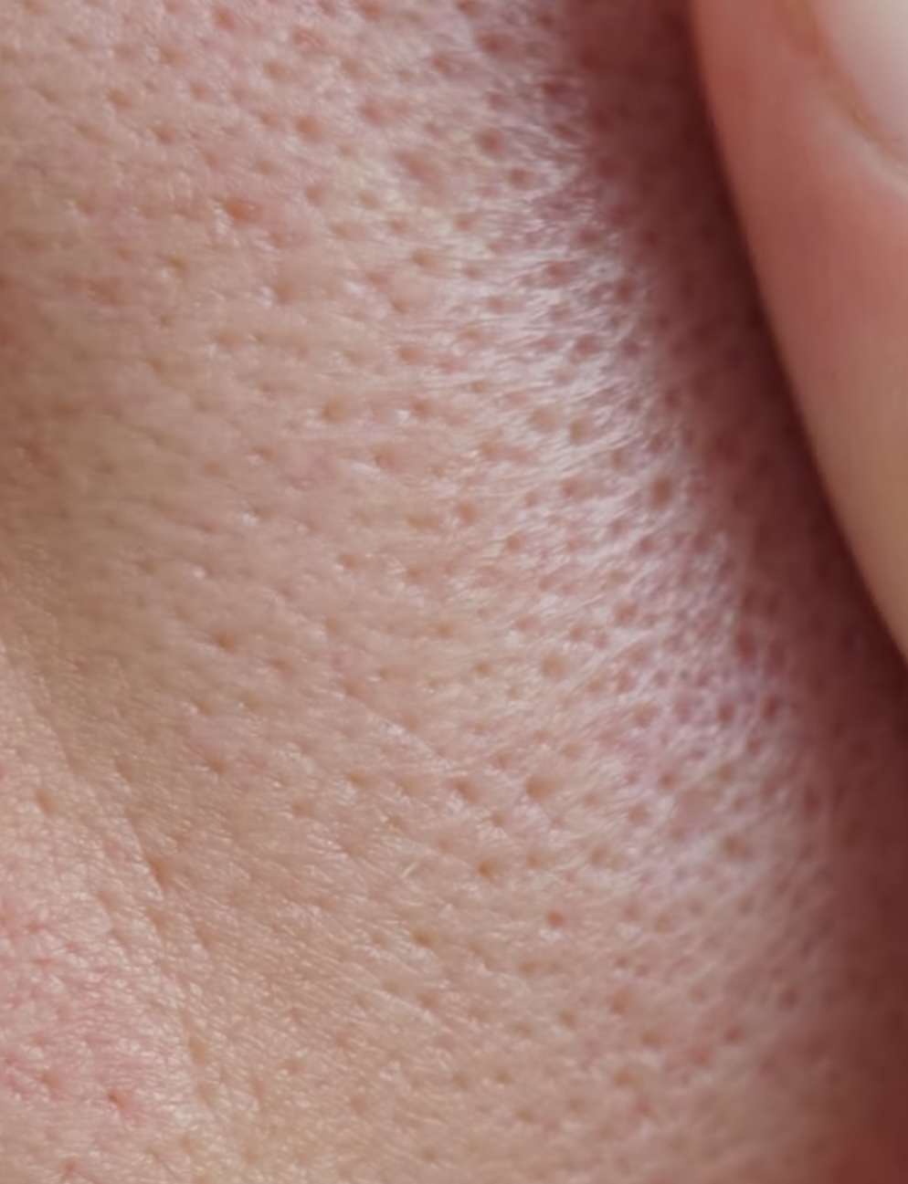 홈케어 모공줄이는법, 모공 커지는 이유