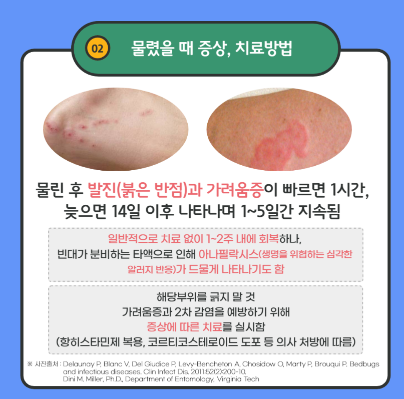 빈대 물림 증상 치료법