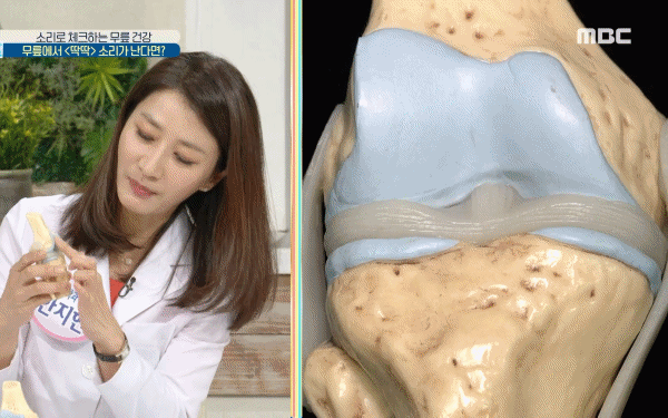 무릎에서 뚝뚝 소리 나는 이유, 앉았다 일어나면 무릎에서 소리가 나요, 무릎에서 소리나고 통증, 건강 팁줌 매일꿀정보