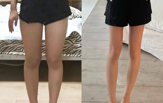 레그필 내돈내산 찐 후기 붓기 부종 부작용 성분 효과 사기?