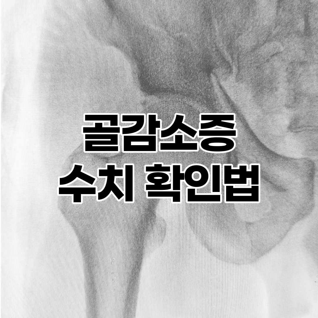 DEXA