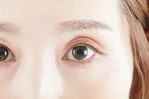 상안검-수술-비용