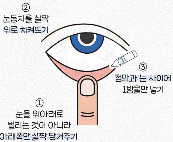 바르게넣는방법
