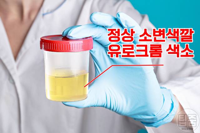 소변색깔 건강상태,갈색 연두색 형광색 주황색 검은색 황갈색 분홍색 파란색,소변색깔이 뿌옇다