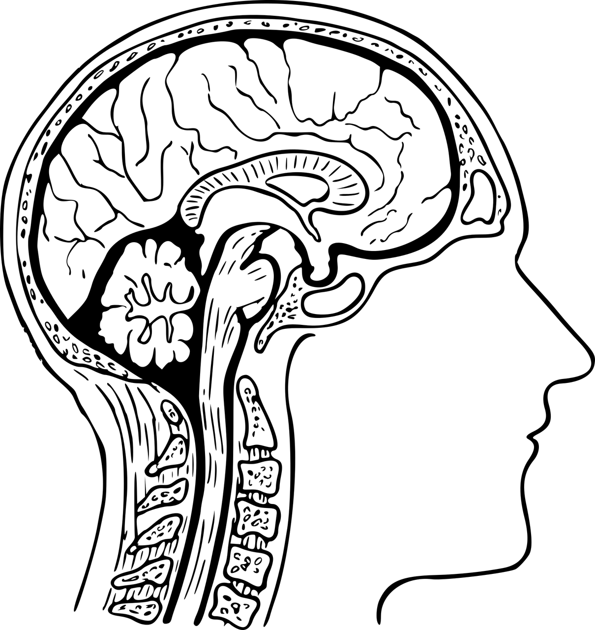 알츠하이머 관련 사진