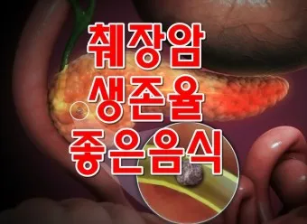 췌장암 초기 증상 췌장암 등통증 위치 검사_9