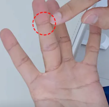 골프 손가락 통증