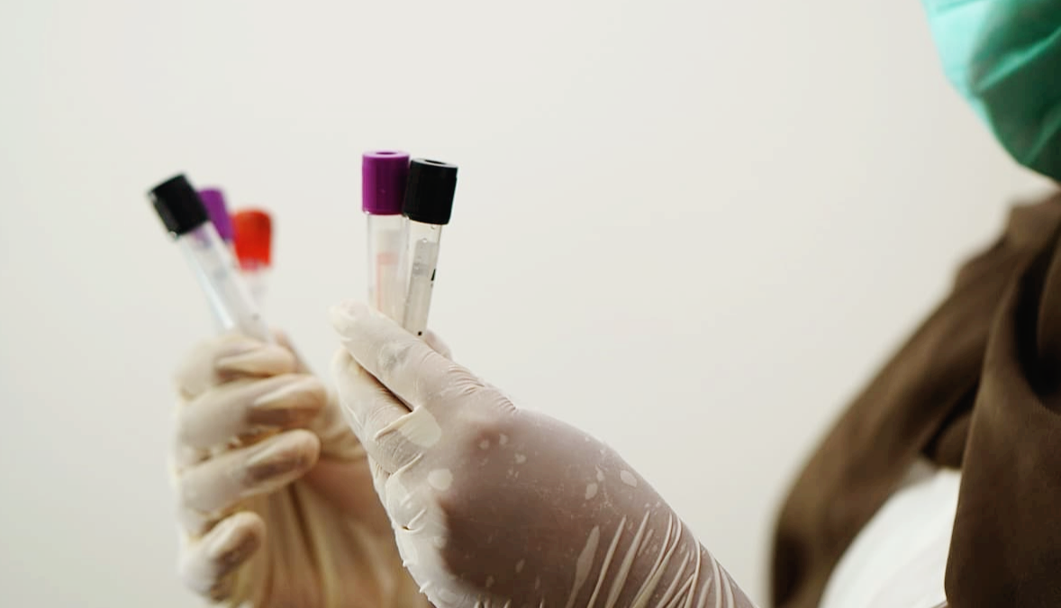 혈액형이 과연 질병에 영향을 줄까? A · B · O · AB형별 건강 위험 요인 분석 : 과학적 연관성