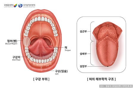 설암 초기증상