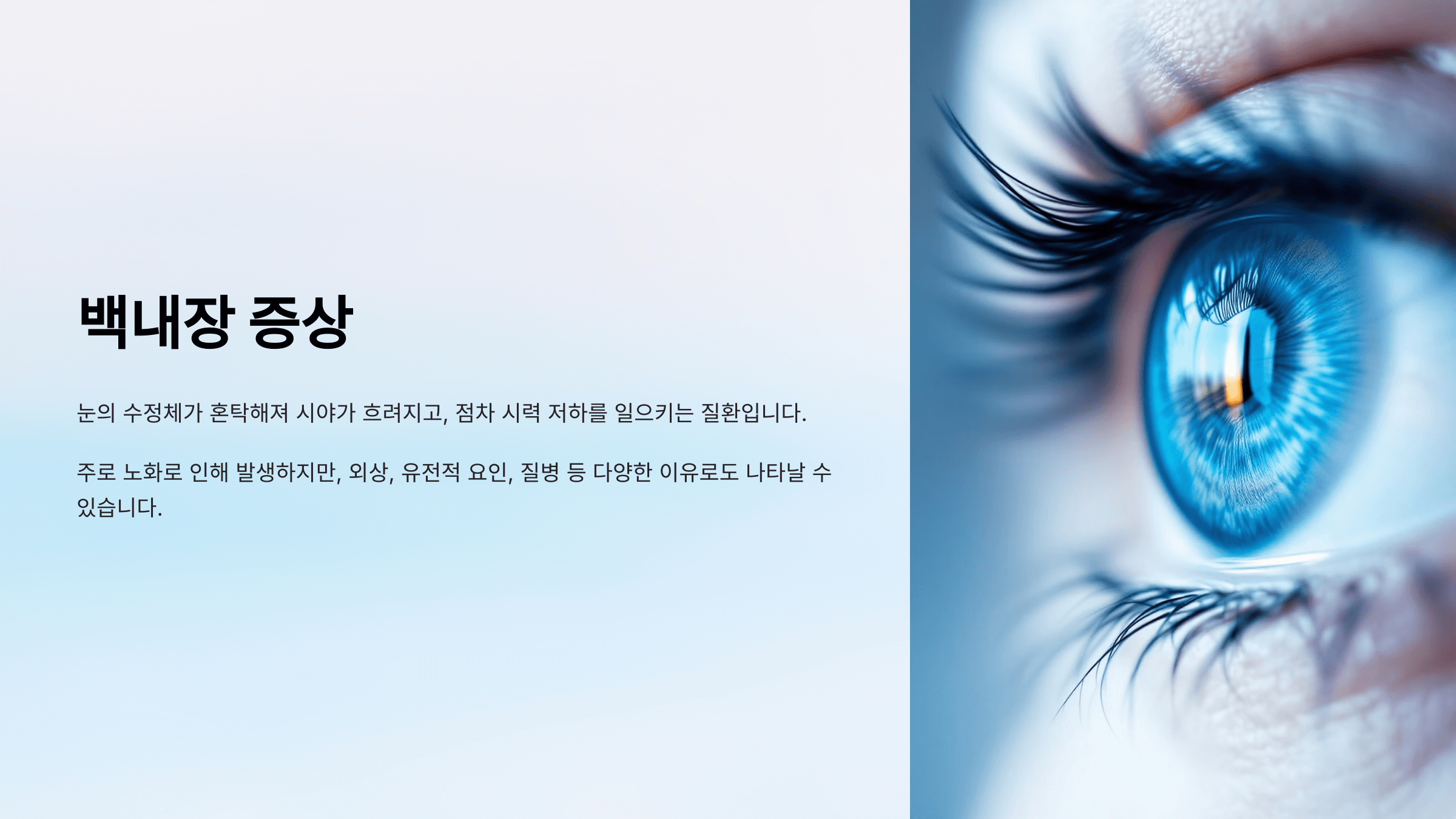 백내장과 관련된 사진입니다.