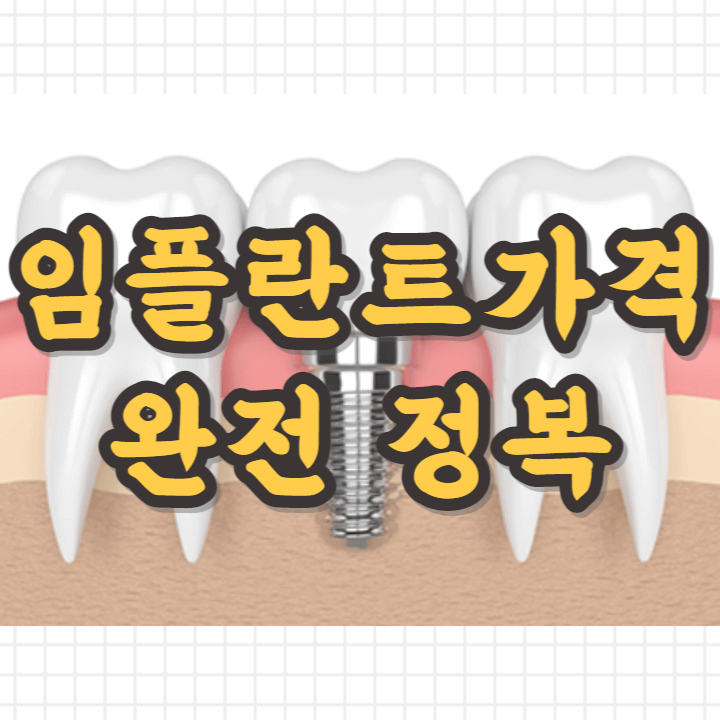임플란트가격-썸네일