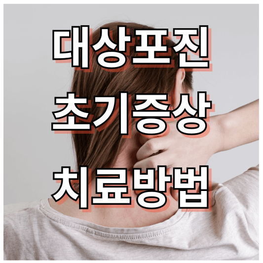 대상포진 초기증상