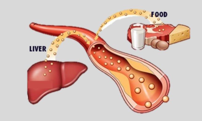 triglycerides 정상 수치