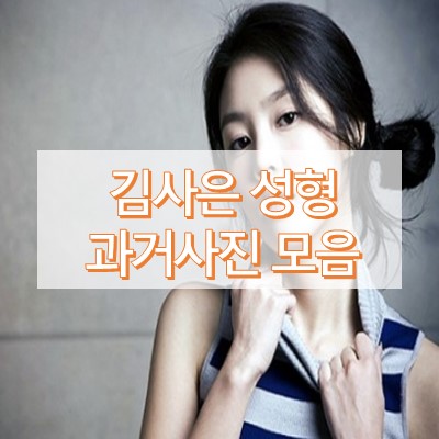 김사은 성형