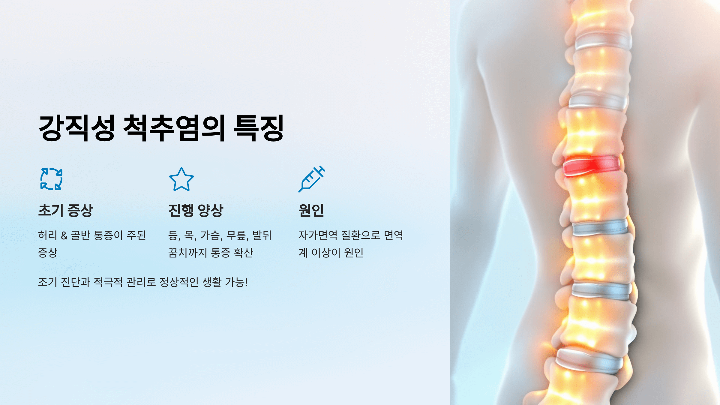 강직성 척추염과 관련된 사진입니다.