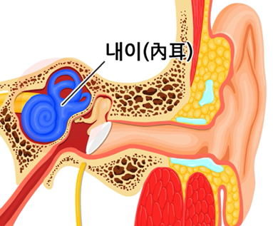 어지럼증 중에서 현훈을 일으키는 귓속 내이 그림