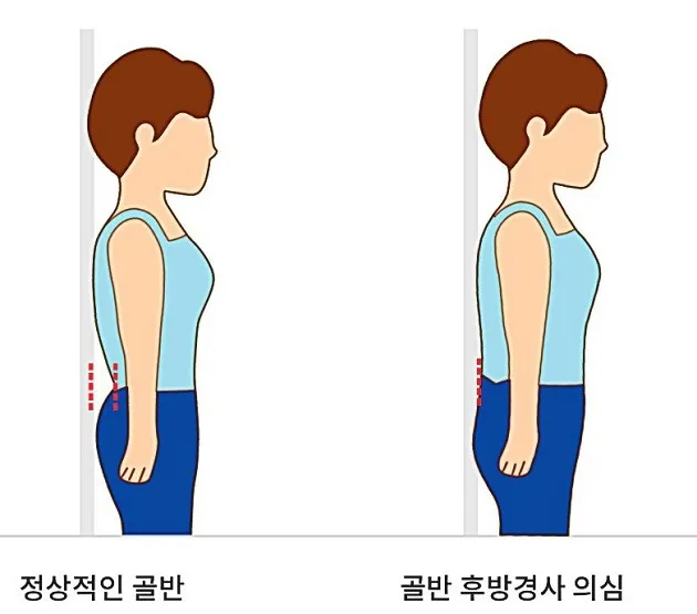 후방경사셀프체크선자세
