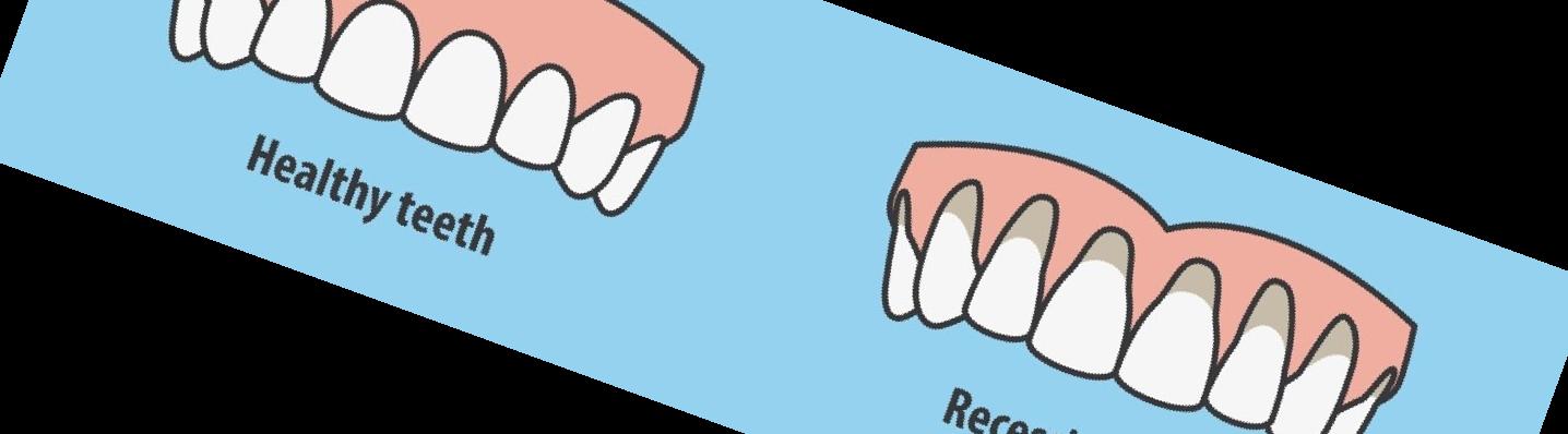 잇몸 내려앉음 치료