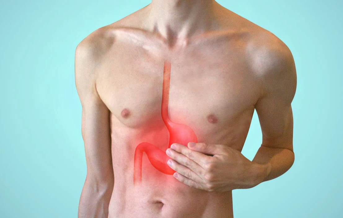 장상피화생이란 위암 확률 증상 치료 음식 관리 방법